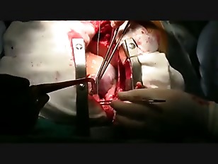Operation Porn - medical surgery Porn Tube Videos at YouJizz